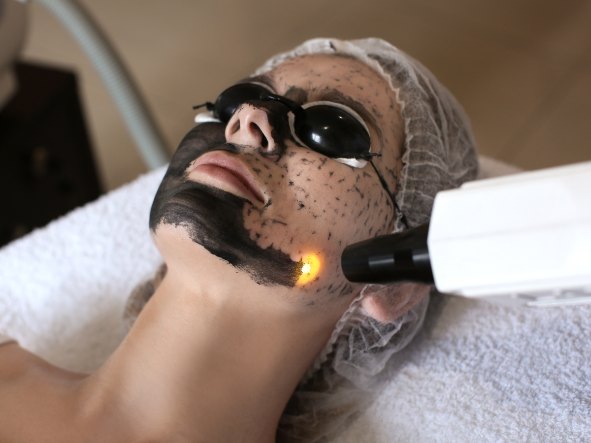 Facial Hollywood Peel