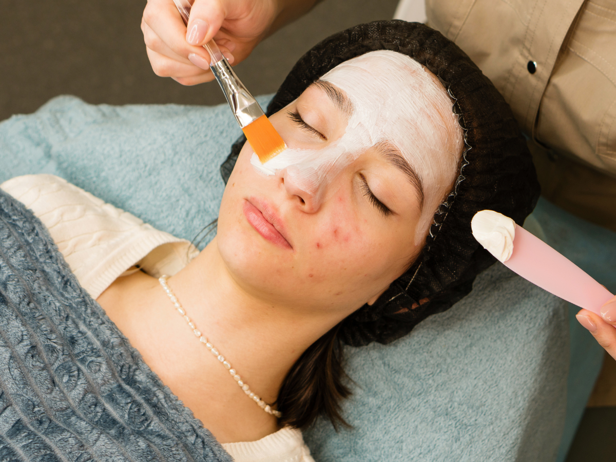 Facial tratamiento para acné