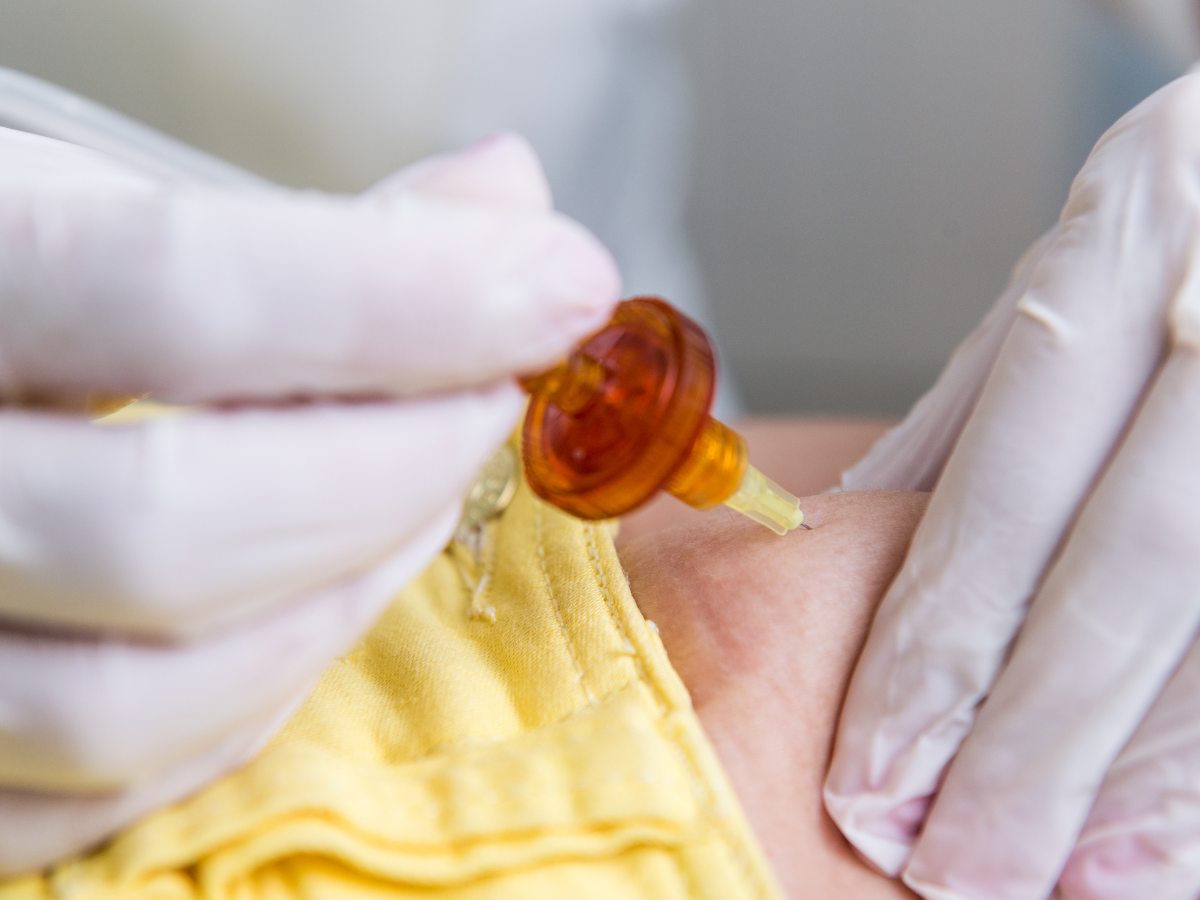 Carboxiterapia en Onzen